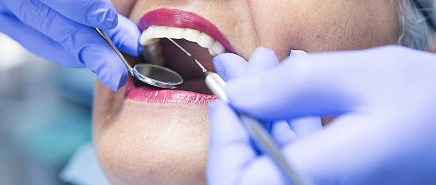 Best Emergency Root Canal Therapy in Lewiston, ME